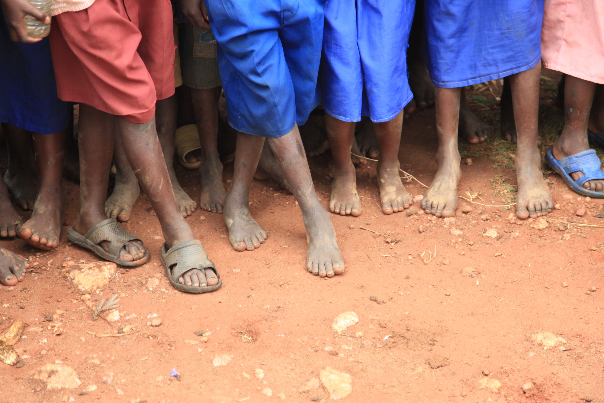 非洲儿童脚